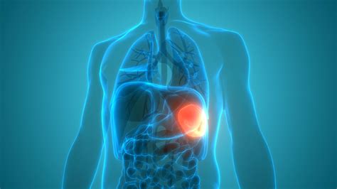 What Is Splenomegaly? Enlarged Spleen Symptoms and Causes - GoodRx