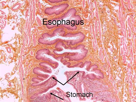 Digestive System | Digestive system, Squamous epithelium, Simple columnar epithelium