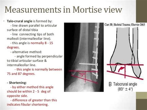 Ankle joint radiography