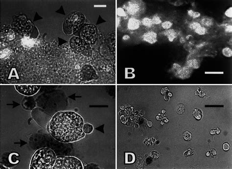 Analysis of target cell death by light microscopy. (A) Amoebae... | Download Scientific Diagram