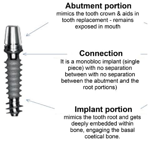 Parts of single piece dental implant. | Download Scientific Diagram