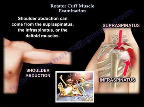 Subscapularis Muscle Test