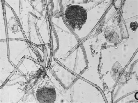 Rhizopus Stolonifer Microscope