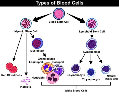 Acute Leukaemia's