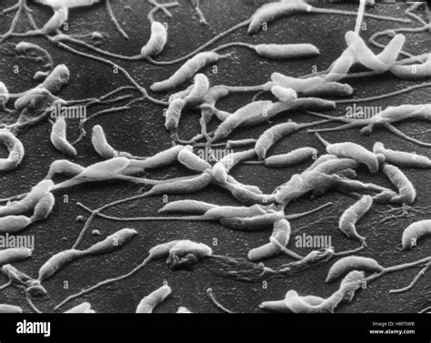 Caulobacter crescentus, SEM Stock Photo - Alamy