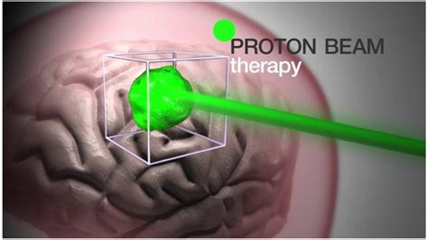 Ashya King case: What is proton beam therapy? - BBC News