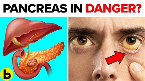 7 Warning Signs Your Pancreas Is In Trouble | Pancreas, Cancer signs ...