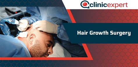 Evolution Of Hair Growth Surgery | ClinicExpert