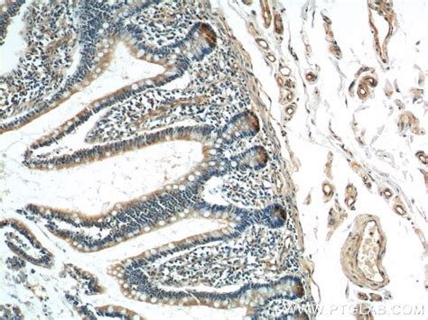 Anti-Lysozyme Antibodies | Invitrogen