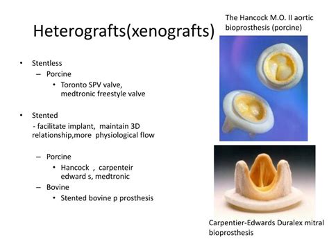 PPT - Prosthetic valves PowerPoint Presentation, free download - ID:5025773