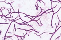 Streptomyces Gram Stain