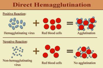 Agglutination in Blood | Definition, Causes & Occurrences | Study.com