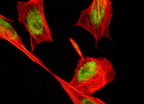 Fibroblasts with Alexa Fluor 568 and LysoTracker DND-26 | MicroscopyU