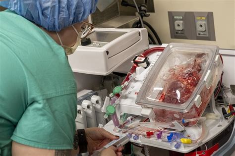 ‘Heart in a Box’ Transplant Is First of Its Kind in Illinois ...