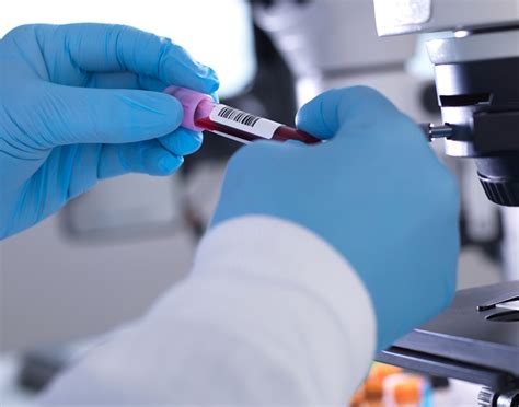 Parathyroid hormone (PTH) blood test