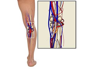 Popliteal Arterial Aneurysm Endovascular Repair