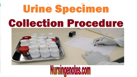 Urine Specimen Collection Procedure - Male, female and infants ...