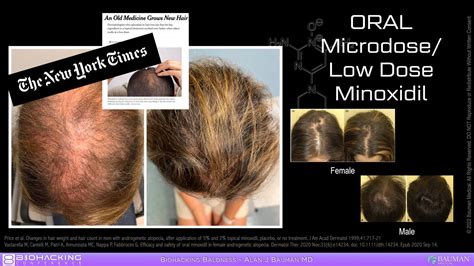 Low Dose Oral Minoxidil For Hair Regrowth · Bauman Medical