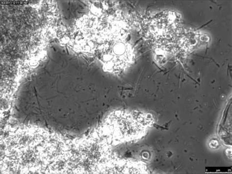 Dental Plaque Sample Under A Microscope