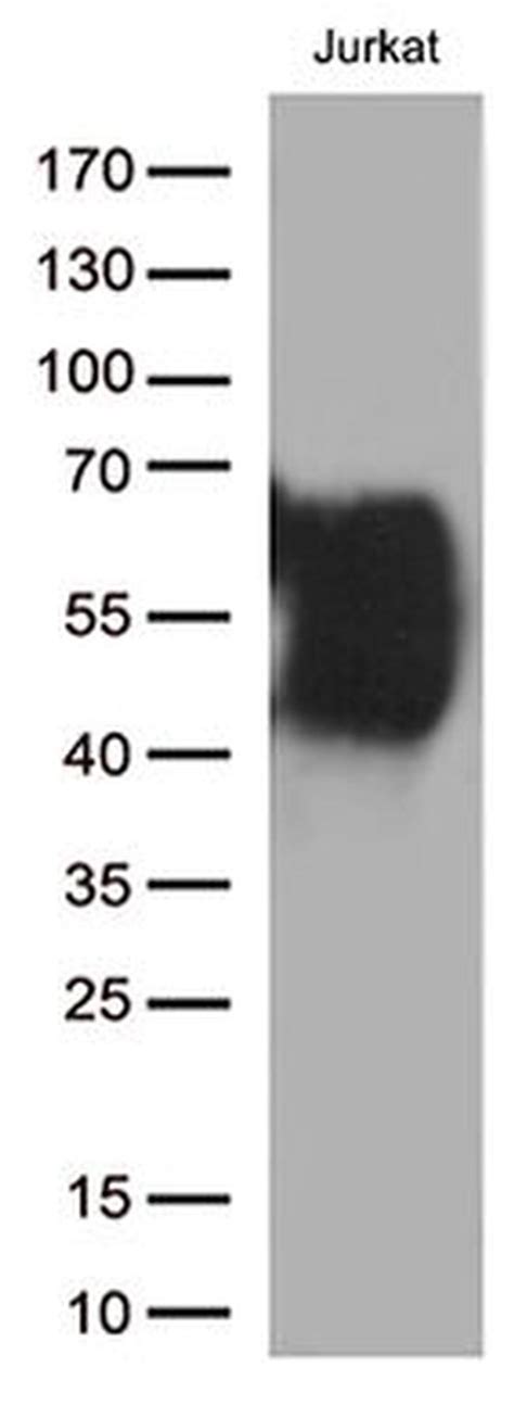 CD2 Monoclonal Antibody (OTI1C5) (CF800655)