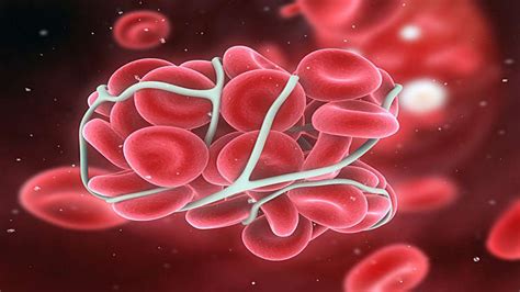 Health Problems Due To Large Red Blood Cells - Boldsky.com