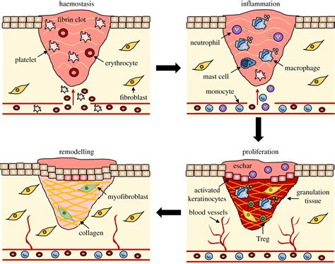 Wound healing: cellular mechanisms and pathological outcomes | Open Biology