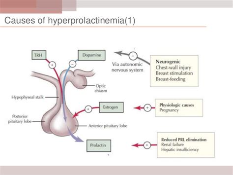 Hyperprolactinemia Causes, Symptoms | Homeopathic Treatment