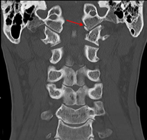 Case #3 - CaseStacks.com