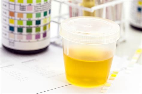 What Blood In Your Urine Can Mean - Beaumont Emergency Hospital