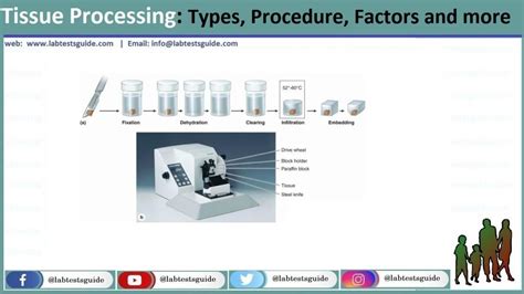 Tissue Processing: Types, Procedure, Factors And More | Lab Tests Guide