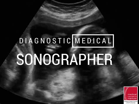 Diagnostic Medical Sonographer | Diagnostic medical sonography, Medical careers, Sonographer