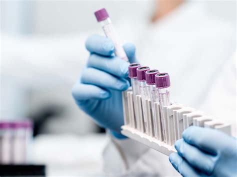 What Role Do Liquid Biopsies Play in the Treatment of NSCLC