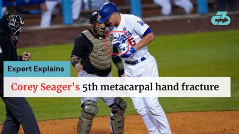 Corey Seager injury (5th metacarpal fracture) | Good news & timeline ...