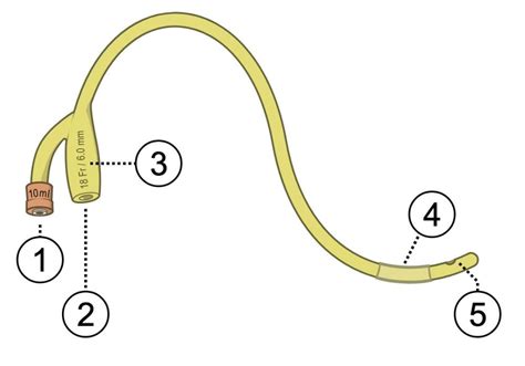 What if Foley does not have sample port? - General Nursing Support