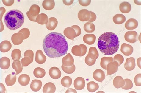 Normal Blood Smear (LM) - Stock Image - C022/2204 - Science Photo Library