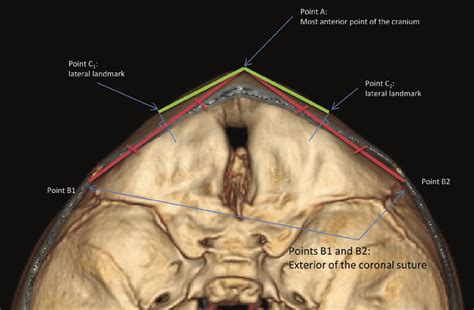 the iFDa is the angle between the line segments connecting points a... | Download Scientific Diagram