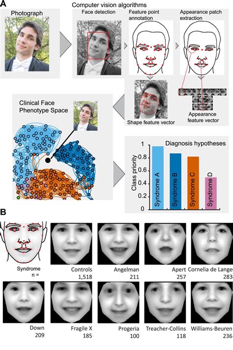 Algorithm identifies rare genetic disorders from family pics | WIRED UK