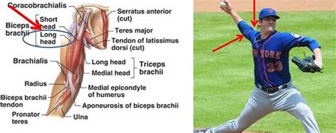 Alternative to Tommy John Surgery | Leading Edge Rehab