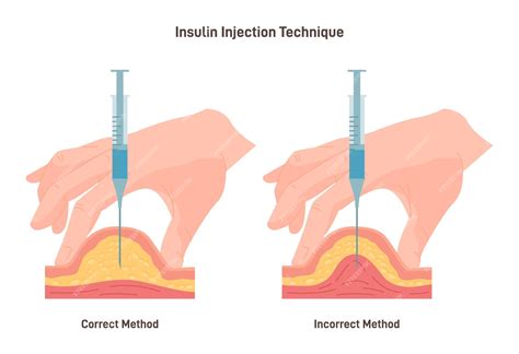 Premium Vector | Insulin injection technique Correct and incorrect way ...