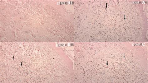 Photomicrographs representing results of orcein staining for elastic... | Download Scientific ...