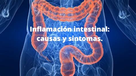 Sintomas Del Intestino Inflamado | Images and Photos finder