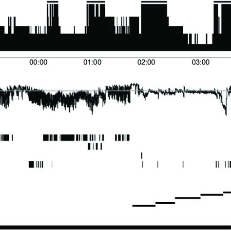 Overnight polysomnogram. Notes: This summary displays a sleep stage... | Download Scientific Diagram