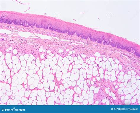 Histology of Epiglottis Human Tissue Stock Image - Image of epithelium, squamous: 147728605