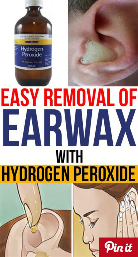 HOW TO USE HYDROGEN PEROXIDE TO REMOVE EAR WAX?