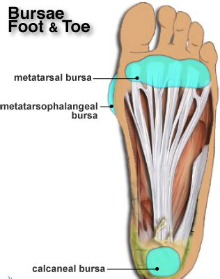 Bursitis in the Foot - Back in Action Physio Injury Information