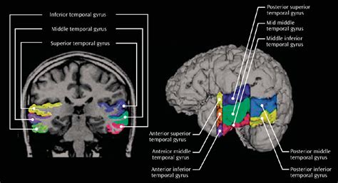 Figure 1 from Middle and Inferior Temporal Gyrus Gray Matter | Semantic Scholar