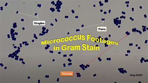 Micrococcus Gram Stained Footages - YouTube