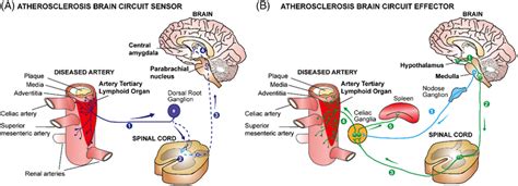 Atherosclerotic arteries are connected to the SENS and the SYNS to form... | Download Scientific ...