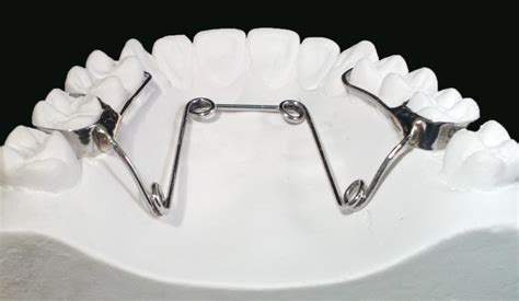 Quad Helix Expander @ OrthoPrime