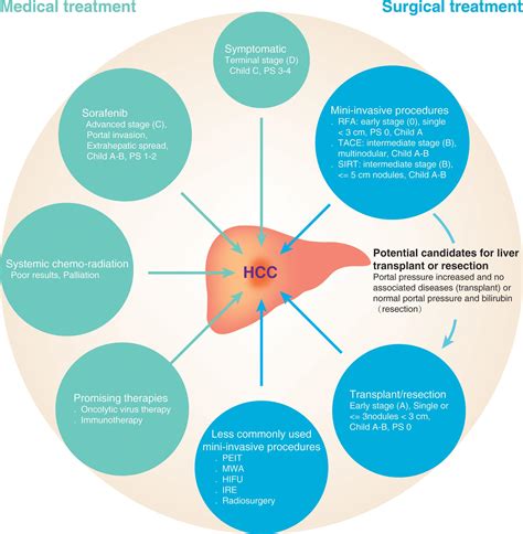 Current and Future Treatment of Hepatocellular Carcinoma: An Updated Comprehensive Review